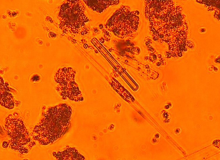 Dictyocha speculum